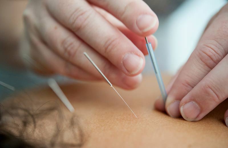 acupuncture-medecine-traditionnelle-chinoise -fourques-66